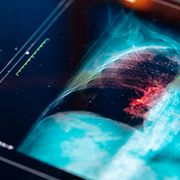 The AI Revolution in Cancer Imaging